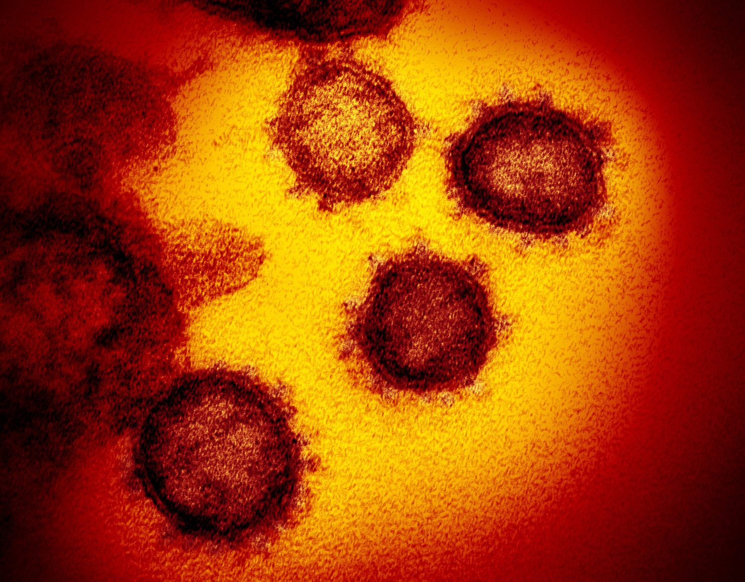 An image from an electron microscope shows SARS-CoV-2, the virus that causes COVID-19. (NIAID-RML/Zuma Press/TNS)